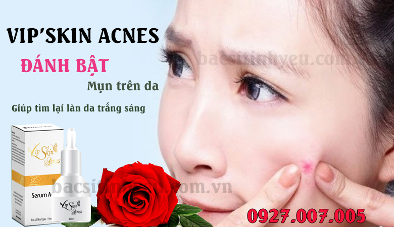 gioi-thieu-acnes