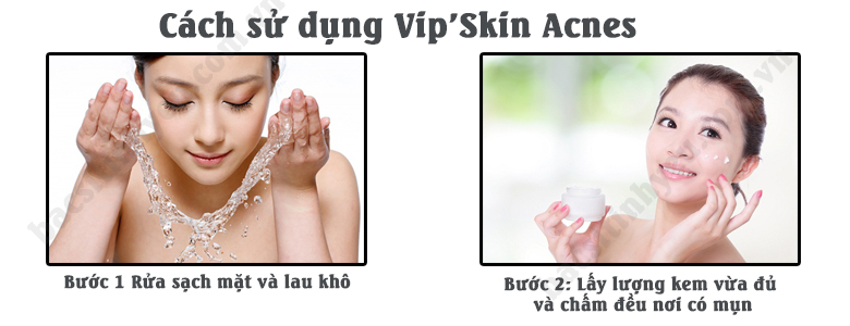huong-dan-sd-vipskin-acnes